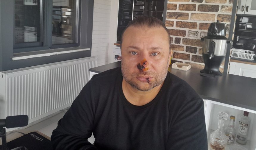 Onur Akay yoğun bakıma kaldırıldı