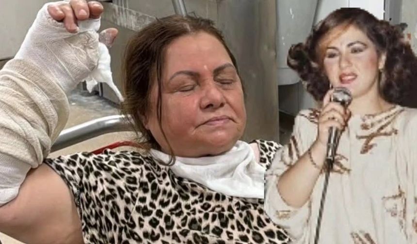 TÜDANYA DÜŞEREK KOLUNU KIRDI
